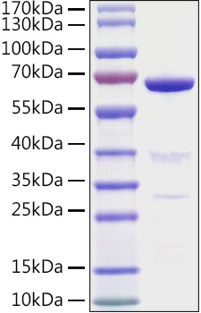 Recombinant Mouse 5'-Nucleotidase/NT5E/CD73 Protein was determined by SDS-PAGE under reducing conditions with Coomassie Blue.