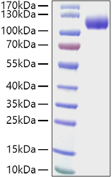 Recombinant Human CDCP1/gp140/CD318 Protein was determined by SDS-PAGE under reducing conditions with Coomassie Blue.