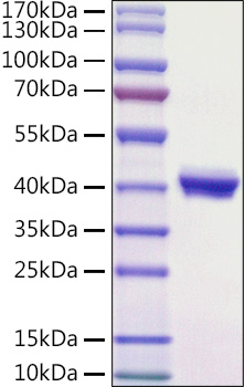 Recombinant Mouse Nectin-4/PVRL4 Protein was determined by SDS-PAGE under reducing conditions with Coomassie Blue.