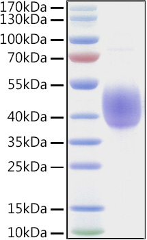 Recombinant Human NKAT-6/KIR2DL2/CD158b1 Protein was determined by SDS-PAGE under reducing conditions with Coomassie Blue.