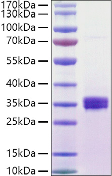 Recombinant Human NKG2D ligand 1/ULBP1 Protein was determined by SDS-PAGE under reducing conditions with Coomassie Blue.