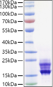 Recombinant Mouse IL-17A/CTLA-8 Protein was determined by SDS-PAGE under reducing conditions with Coomassie Blue.