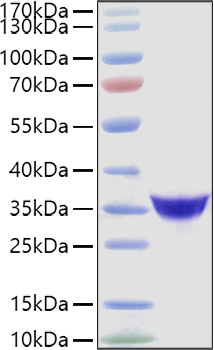 Recombinant Human Adiponectin/Acrp30/ADIPOQ Protein was determined by SDS-PAGE under reducing conditions with Coomassie Blue.