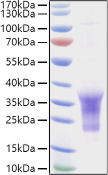 Recombinant Human B29/CD79B Protein was determined by SDS-PAGE under reducing conditions with Coomassie Blue.
