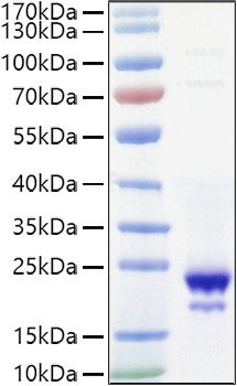 Recombinant Mouse IL-10 Protein was determined by SDS-PAGE under reducing conditions with Coomassie Blue.