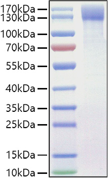 Recombinant Mouse OSMR/IL-31RB Protein was determined by SDS-PAGE under reducing conditions with Coomassie Blue.