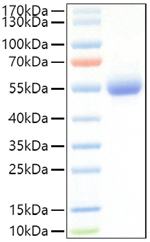 Recombinant Mouse IL-5RA/CD125 Protein was determined by SDS-PAGE under reducing conditions with Coomassie Blue.