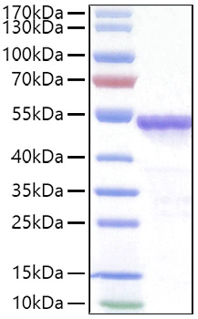 Recombinant SARS-COV-2 Nucleocapsid(D63G,R203M,D377Y) Protein was determined by SDS-PAGE under reducing conditions with Coomassie Blue.