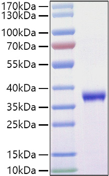 Recombinant SARS-COV-2 Spike RBD(L452R,T478K) Protein was determined by SDS-PAGE under reducing conditions with Coomassie Blue.