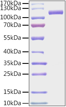 Recombinant Mouse CDCP1/gp140/CD318 Protein was determined by SDS-PAGE under reducing conditions with Coomassie Blue.