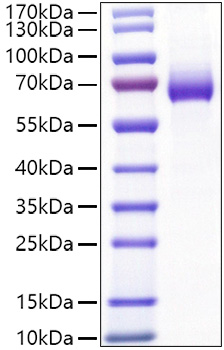Recombinant Mouse IL-2RA/CD25 Protein was determined by SDS-PAGE under reducing conditions with Coomassie Blue.