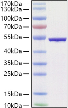 Recombinant SARS-COV-2 Nucleocapsid(B.1.1.529/Omicron) Protein was determined by SDS-PAGE under reducing conditions with Coomassie Blue.