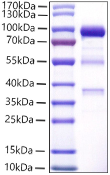 Recombinant Human Carboxypeptidase E/CPE Protein was determined by SDS-PAGE under reducing conditions with Coomassie Blue.