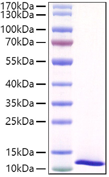 Recombinant Mouse SPINK4 Protein was determined by SDS-PAGE under reducing conditions with Coomassie Blue.
