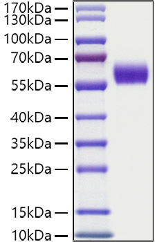 Recombinant Human HGK2/DDR1/CD167a Protein was determined by SDS-PAGE under reducing conditions with Coomassie Blue.