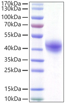 Recombinant Human DC-SIGN/CD209 Protein was determined by SDS-PAGE under reducing conditions with Coomassie Blue.