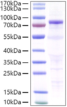 Recombinant Human CDH3/P-cadherin Protein was determined by SDS-PAGE under reducing conditions with Coomassie Blue.