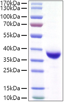 Recombinant SARS-CoV-2 Spike RBD(Lambda/C.37) Protein was determined by SDS-PAGE under reducing conditions with Coomassie Blue.