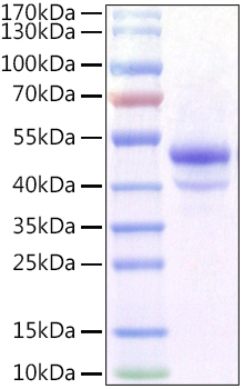 Recombinant Mouse Carbonic Anhydrase IX/CA9 Protein was determined by SDS-PAGE under reducing conditions with Coomassie Blue.