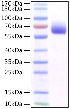Recombinant Mouse FGFR-1/CD331 Protein was determined by SDS-PAGE under reducing conditions with Coomassie Blue.