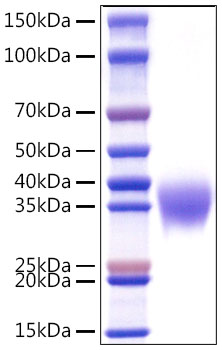 Recombinant Human Apolipoprotein H/ApoH Protein was determined by SDS-PAGE under reducing conditions with Coomassie Blue.