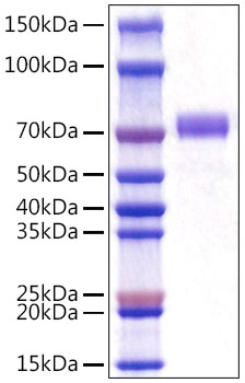 Recombinant Mouse CD5 Protein was determined by SDS-PAGE under reducing conditions with Coomassie Blue.