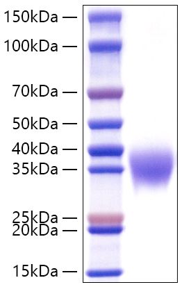 Recombinant Mouse Fc gamma RIIB/FCGR2B/CD32b Protein was determined by SDS-PAGE under reducing conditions with Coomassie Blue.