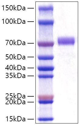 Recombinant Human GOLPH2/GOLM1 Protein was determined by SDS-PAGE under reducing conditions with Coomassie Blue.