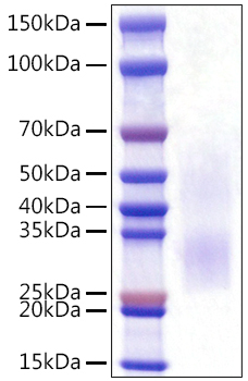 Recombinant Rat PD-1/PDCD1/CD279 Protein was determined by SDS-PAGE under reducing conditions with Coomassie Blue.