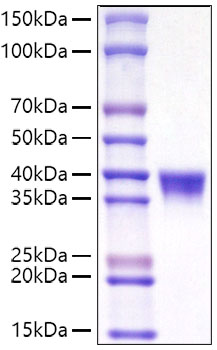 Recombinant Mouse CD38 Protein was determined by SDS-PAGE under reducing conditions with Coomassie Blue.