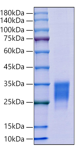 Recombinant Mouse CD69 Protein was determined by SDS-PAGE under reducing conditions with Coomassie Blue.