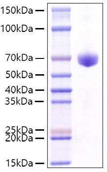 Recombinant Mouse CD8a Protein was determined by SDS-PAGE under reducing conditions with Coomassie Blue.