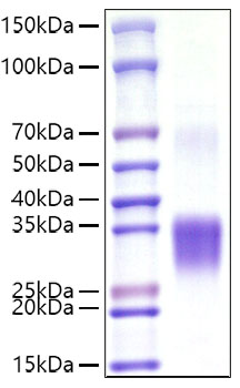 Recombinant Mouse CD8a Protein was determined by SDS-PAGE under reducing conditions with Coomassie Blue.
