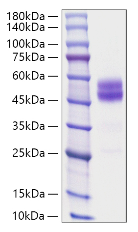 Recombinant Mouse TIGIT Protein was determined by SDS-PAGE under reducing conditions with Coomassie Blue.