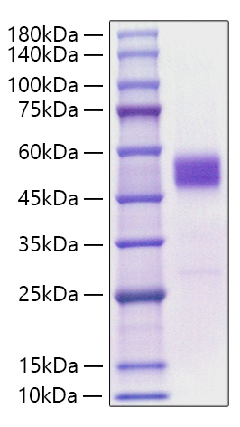 Recombinant Mouse TIGIT Protein was determined by SDS-PAGE under reducing conditions with Coomassie Blue.