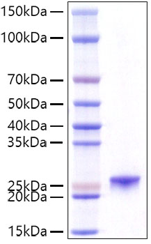 Recombinant Mouse Prolactin/PRL Protein was determined by SDS-PAGE under reducing conditions with Coomassie Blue.