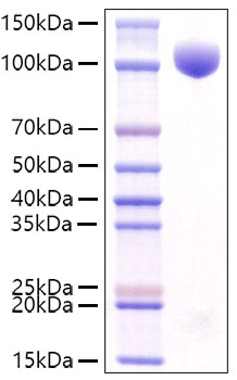 Recombinant Mouse c-kit/CD117 Protein was determined by SDS-PAGE under reducing conditions with Coomassie Blue.