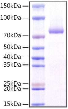 Recombinant Human CLEC7A/Dectin-1/CD369 Protein was determined by SDS-PAGE under reducing conditions with Coomassie Blue.