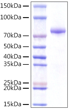 Recombinant Human Integrator complex subunit 14/VWA9/INTS14 Protein was determined by SDS-PAGE under reducing conditions with Coomassie Blue.