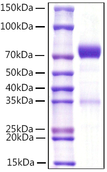Recombinant Mouse NKp46/NCR1/CD335 Protein was determined by SDS-PAGE under reducing conditions with Coomassie Blue.