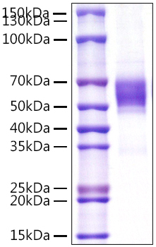 Recombinant Human NKG2-D/KLRK1/CD314 Protein was determined by SDS-PAGE under reducing conditions with Coomassie Blue.