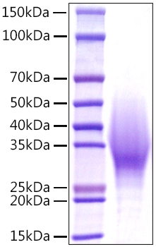Recombinant Mouse IL-18BP Protein was determined by SDS-PAGE under reducing conditions with Coomassie Blue.