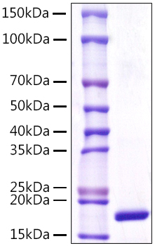Recombinant Human Lipocalin-1/LCN1 Protein was determined by SDS-PAGE under reducing conditions with Coomassie Blue.
