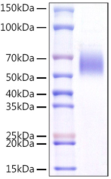 Recombinant Mouse IL1RL1/ST2 Protein was determined by SDS-PAGE under reducing conditions with Coomassie Blue.