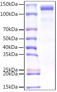 Recombinant Human CDCP1/gp140/CD318 Protein was determined by SDS-PAGE under reducing conditions with Coomassie Blue.