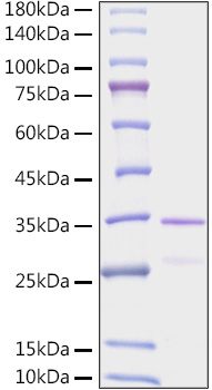 Recombinant Human EGLN1/PHD2 Protein was determined by SDS-PAGE under reducing conditions with Coomassie Blue.