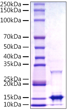 Recombinant Monkeypox virus A29 Protein was determined by SDS-PAGE under reducing conditions with Coomassie Blue.