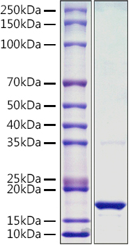 Recombinant Monkeypox virus L1R Protein was determined by SDS-PAGE under reducing conditions with Coomassie Blue.