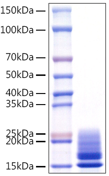 Recombinant Monkeypox virus A29 Protein was determined by SDS-PAGE under reducing conditions with Coomassie Blue.