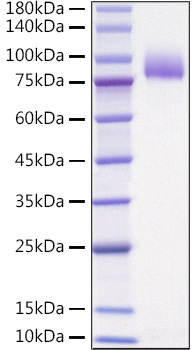 Recombinant Human IL-1 Rrp2/IL-1 R6 Protein was determined by SDS-PAGE under reducing conditions with Coomassie Blue.